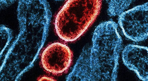 Virus Nipah, cos'è e quanto è pericoloso. Allarme in India (ma non sarà una nuova pandemia)