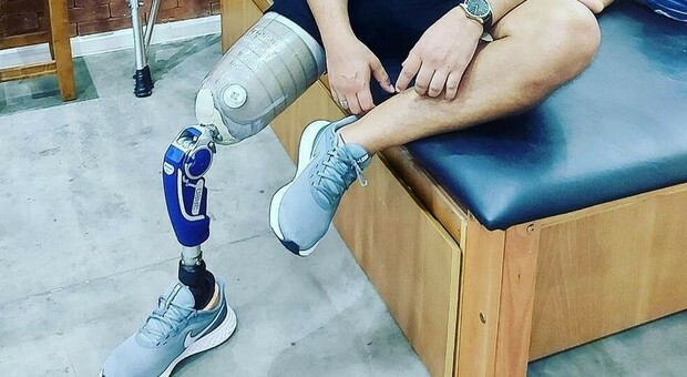Giovane contrae un'infezione in ospedale e gli viene amputata una gamba, ora lotta per pagarsi la protesi
