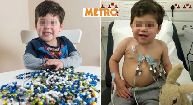 Oliver, 20 mesi, malato di cancro colleziona perline per ogni trattamento medico: "Ne ha oltre 1500"