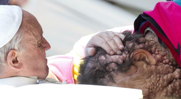 Addio a Vinicio, l'uomo dal volto deturpato che Papa Francesco abbracciò 10 anni fa: l'immagine simbolo della tenerezza