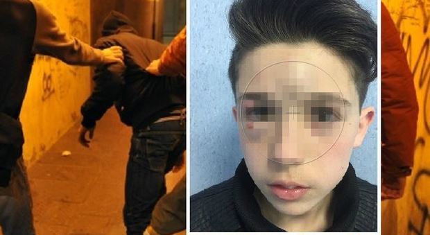 Fabio picchiato dai bulli a 13 anni, il papà su Facebook: "Denunciate perché non devono passarla liscia" -Guarda