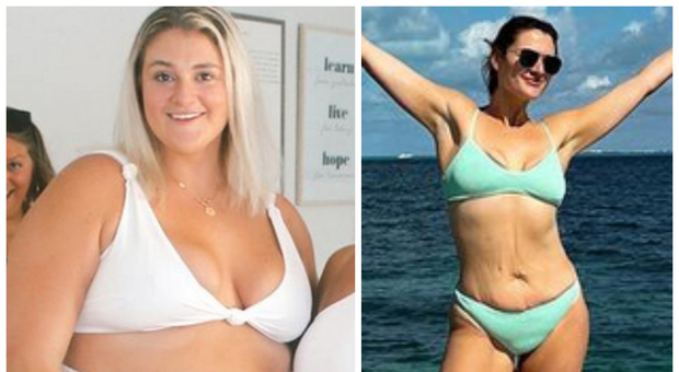 Malata di binge eating, ha perso 90 kg in meno di un anno: «La mia è cambiata, mi sono accettata»