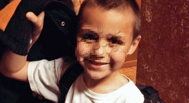 Bimbo di 10 anni ucciso dalla mamma perché gay: le dichiarazioni choc della sorellina