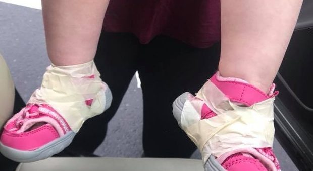 La bimba di 17 mesi si toglie spesso le scarpe, le maestre le bloccano i piedi con il nastro adesivo