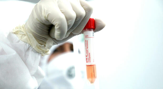 Coronavirus, in Abruzzo celle per il super-freddo in grado di conservare il vaccino
