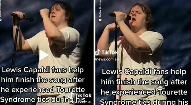 Lewis Capaldi, la sindrome di Tourette gli impedisce di cantare e i fan lo fanno per lui. Il video commovente su TikTok