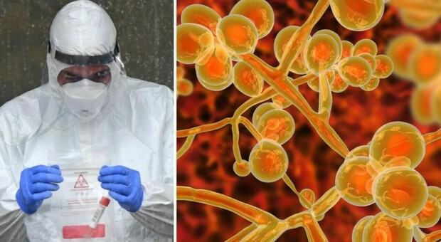 Candida auris killer, uomo morto a Milano: «Contagiato dal fungo e da vari batteri. Arrivava dalla Grecia»