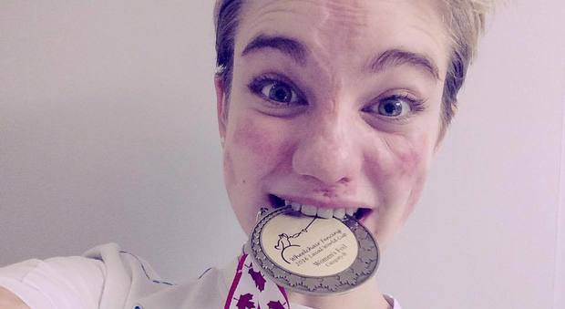 Bebe Vio con la medaglia d'oro nel selfie postato su Facebook
