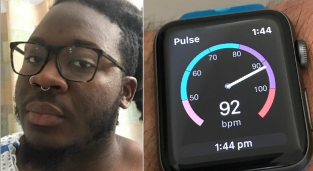 New York, ha un'embolia e l'Apple Watch lo avverte: «Mi ha salvato la vita»