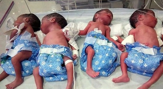 India, partorisce cinque gemelle in mezz'ora: era convinta di aspettare un solo bambino