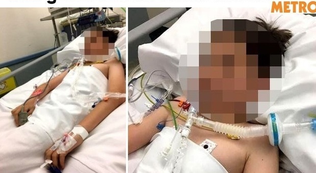 Beve vodka a scuola, 12enne finisce in ospedale: le foto choc diffuse dalla mamma