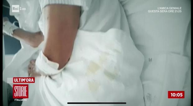 Caserta, anziana legata al letto in mezzo a urina e sangue: il video drammatico