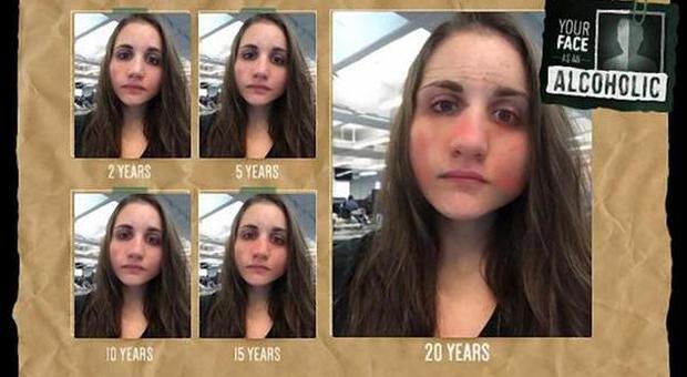 Gli effetti dell'alcol sul volto: un sito mostra i danni dopo 5, 10 e 20 anni