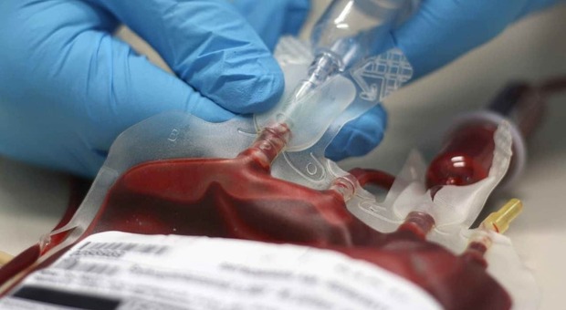 Trasfusione di sangue