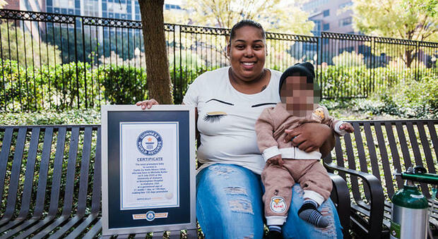 Baby Curtis è il neonato prematuro da record: nato a 21 settimane e 1 giorno in Alabama