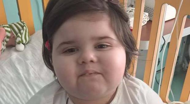 Matilde muore a 2 anni a causa di una rara malattia: "Malefica ha vinto, ma ci resta il tuo sorriso"