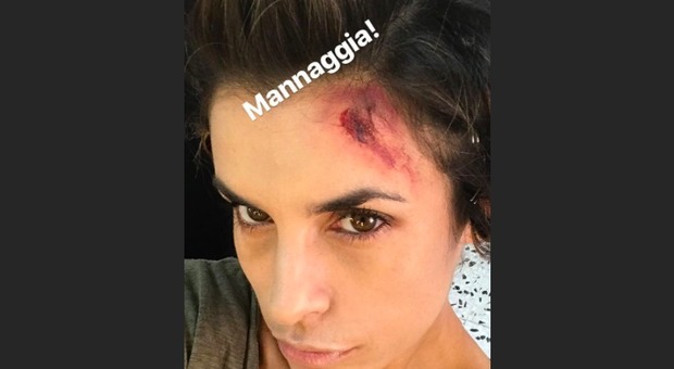 Elisabetta Canalis ferita alla testa, fan spaventati su Instagram: cosa sta succedendo