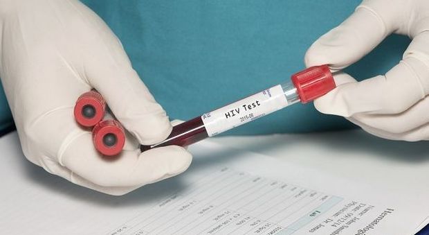 Aids, test Hiv a minori senza consenso dei genitori: sì del Garante Infanzia