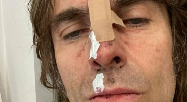 Liam Gallagher, paura per l'ex Oasis: cade dall'elicottero e si ferisce al volto