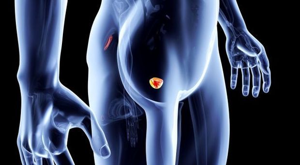 Tumore alla prostata, nuove cure chemio-free promettono 4 anni di vita in più