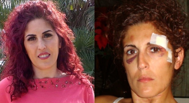 Lidia Vivoli, sopravvissuta all'inferno: «Il mio ex cercò di uccidermi. Ora è già fuori dal carcere»