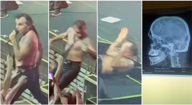 Piero Pelù, incidente sul palco al concerto di Milano: cade e sbatte la testa su un gradino, ecco come sta