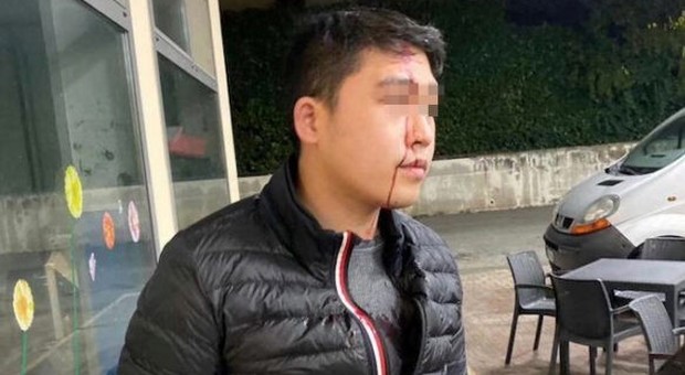 Coronavirus, ragazzo di origine cinese aggredito in Veneto: «Mi hanno spaccato una bottiglia in faccia»