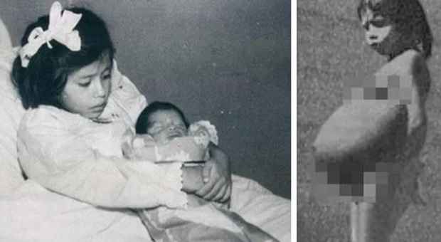 Mamma a 5 anni, l'incredibile caso di Lina Medina: la bambina più giovane nella storia ad aver partorito. «Mai ricevuto aiuto»