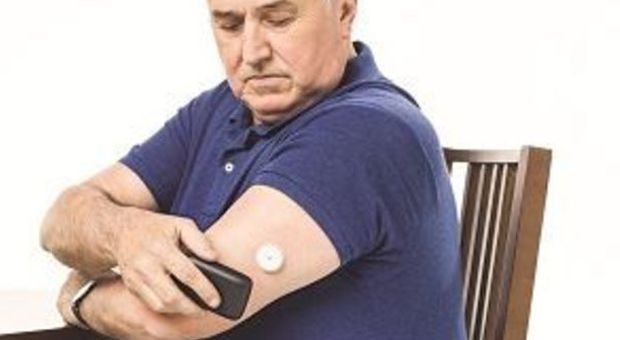 Diabete, il glucosio si misura senza pungersi il dito, basta un piccolo sensore