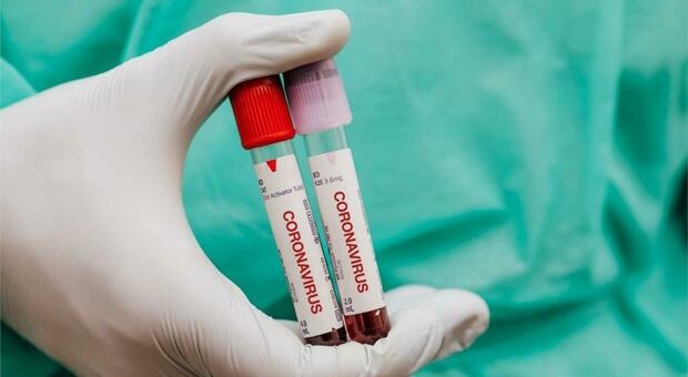 Coronavirus in Italia, ancora record di contagi. Oggi 199 morti e 31.084 casi in più