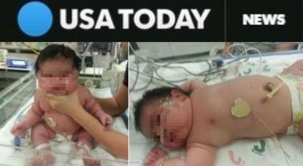 Mia, la neonata da record: pesa più di 6 kg. "I medici avevano previsto la metà"