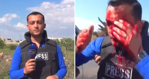 Siria, reporter colpito da schegge di granata sul viso in diretta tv