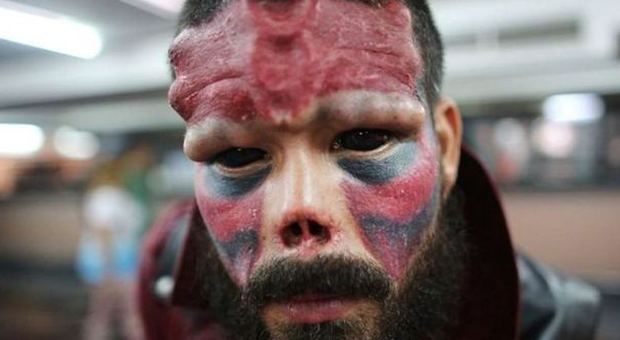 Sogna di diventare Red Skull: si fa mutilare il naso per somigliare al personaggio cattivo dei fumetti
