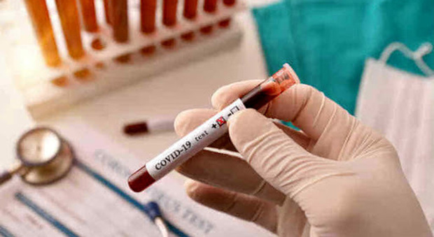 Coronavirus, arriva il test sierologico: sarà disponibile da maggio