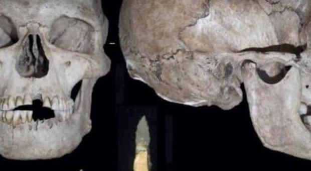 Scoperta carie trattata 14mila anni fa: il primo dentista è stato un feltrino