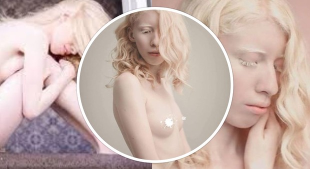 La modella albina racconta di essere stata vittima dei bulli: "La diversità è una benedizione"
