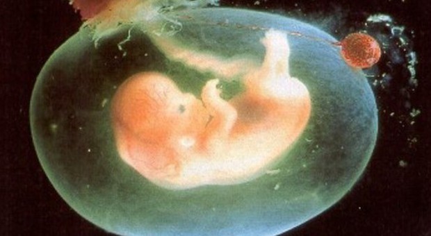 Un milione di dollari per non abortire: la richiesta choc di una 26enne sul web