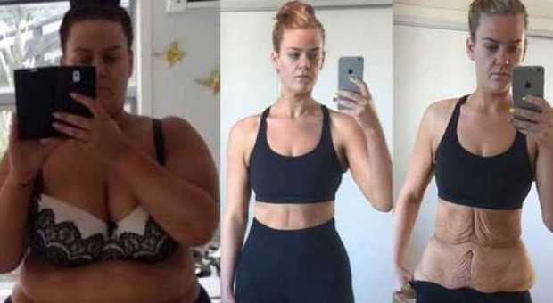Perde 90 chili in 11 mesi, ma i fan non le credono: e lei pubblica questa foto