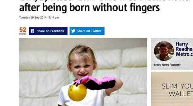 Hayley, 5 anni, non ha le dita dell'arto sinistro: in regalo riceve la mano bionica di Iron Man