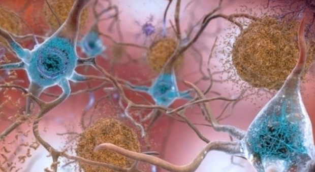Alzheimer, allarme cibi salati. Scienziato italiano: «Possono causare declino cognitivo»