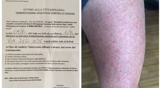 Chikungunya, altri due casi a Roma nord: «Io e mia moglie colpiti dal virus»