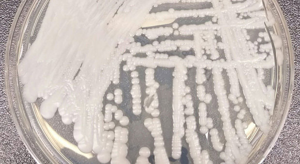 Candida auris, il fungo resistente agli antibiotici che preoccupa i medici: «Può uccidere in 3 mesi»