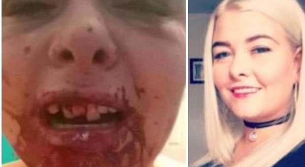 Donna picchiata a sangue dal compagno violento: aveva cambiato foto profilo su Facebook