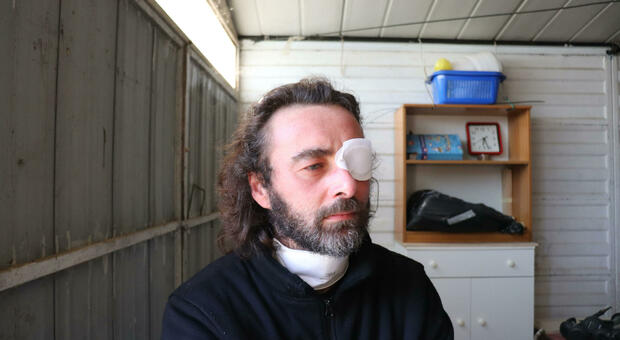 Don Riccardo, il prete innamorato con una benda sull'occhio: «Ho pianto troppo. Ora provo un senso di libertà»