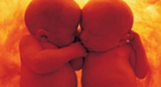 Napoli, gemelli abbracciati nel grembo di mamma affetta da tumore: salvati