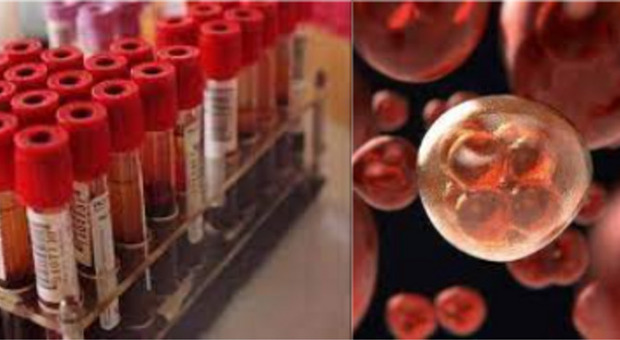 Tumore del sangue, scoperta nuova immunoterapia che può rallentare la progressione della malattia del 74%
