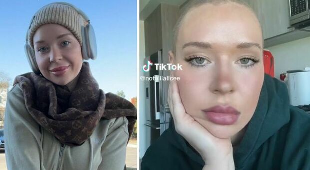 TikTok, la donna più sfortunata del mondo: «Picchiata da un senzatetto, ho scoperto un tumore al cervello e sono anche stata investita fuori dall'ospedale»