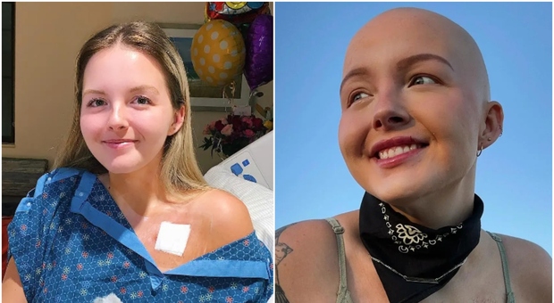 Cancro terminale a 26 anni, Maddy Baloy racconta la sua storia su TikTok poi muore. «Era così speciale»