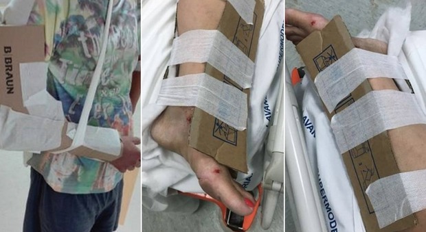 Cartoni usati come gessi per immobilizzare le fratture, incredibile all'ospedale di Reggio Calabria