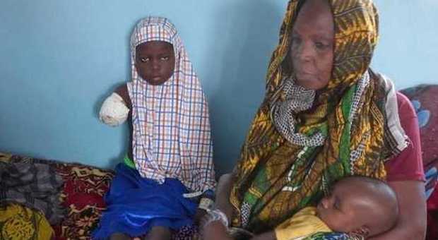 Hadjara, una bimba di 8 anni, mutilata da Boko Haram